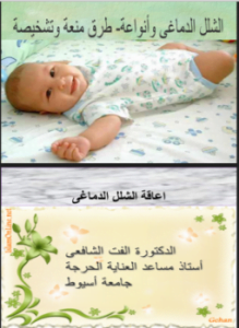 اعاقة الشلل الدماغى