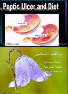 قرحة المعدة والتغذية